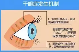 眼睛干怎么办？细扒几款网红眼药水图片