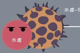 为何带状疱疹会“不请自来”？带状疱疹怎么预防？图片