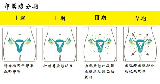 医生带你解读肿瘤标志物——ca125