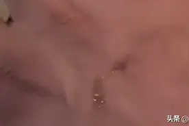 男子被蛇咬，三亚交警接力送医，手臂肿得像包子，什么蛇这么毒？图片