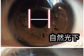冻知识：一个人爱不爱你，看瞳孔反应就知道？图片