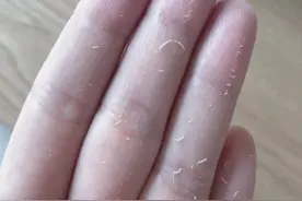 用的精华和面霜会“搓泥”！是买到假货了吗？图片