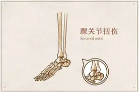 脚踝关节韧带损伤的症状和日常保养方法图片