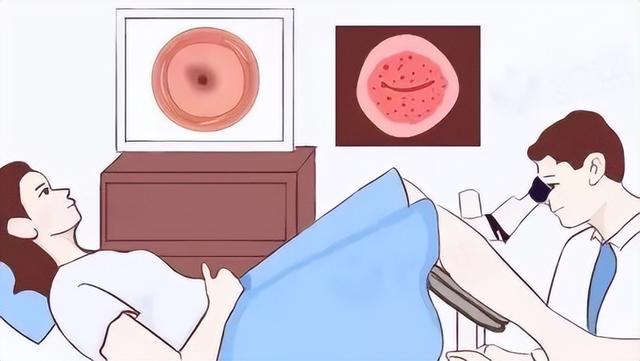 伊森:阴道镜类似放大镜,但胜于放大镜.