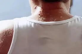 动不动就出汗？是身子虚吗？医生：三种出汗属于异常，多加注意图片