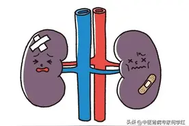 肌酐高不适合吃的食物有哪些？图片