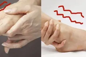 脸麻、手麻、脚麻、肢体麻木，用这两味药就够了，解一身麻木图片