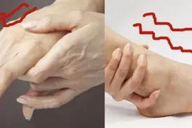 脸麻、手麻、脚麻、肢体麻木，用这两味药就够了，解一身麻木图片