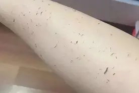 为什么不能总搓澡“洗浴王”搓下不仅是“泥”，更是你的“健康”图片