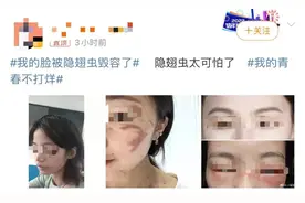 这种虫千万别拍！毒液堪比硫酸，有人差点毁容、失明图片