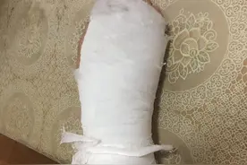 掉坑掉坑！70岁上海老伯，摔成骨折！半年多，“挖坑的”就是没说法图片