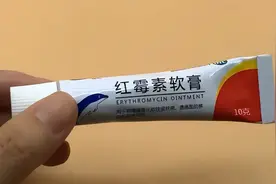 2块钱一支的红霉素软膏被称为“淡斑专家”？医生告诉你答案图片