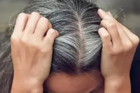 人真的会因为极度悲伤和绝望，一夜白头吗？图片