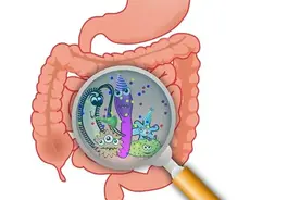 胃肠息肉是小事，还是癌变信号？这种息肉建议切除图片