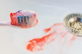 经常刷牙出血，也许你不知道的东西在这图片