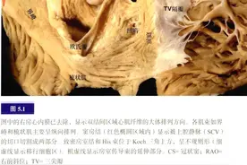 心脏解剖：心脏传导系统和旁道图片
