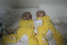 09年首例坐骨连体姐妹分离成活，如今妈妈生了弟弟，一家人很幸福图片