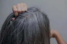 女性头上白发增多，别认为老了，可能是体内缺乏这3种营养元素图片
