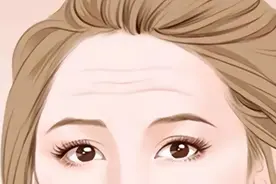 抬头纹该如何改善图片