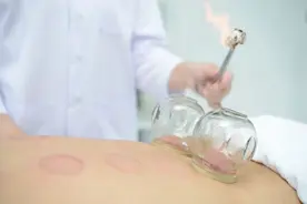 拔上一罐，病去一半！颜色越深“毒”越多？吸出的瘀血是体内毒素？告诉你真相，看完涨知识图片