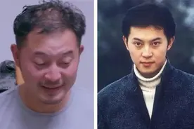 脱发油腻、秃顶发腮、脸部塌方、细数6位男神颜值的“暴跌”之路图片