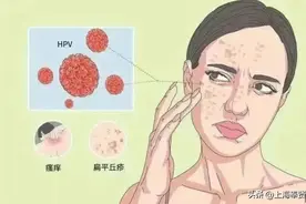 皮肤上的小疙瘩到底是什么？| 贤医健康说图片