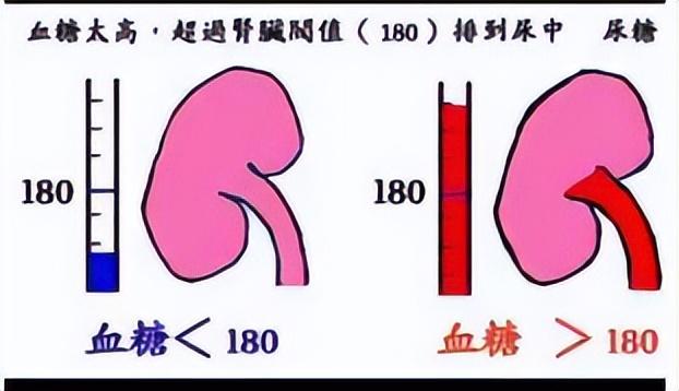 您了解尿糖“阳性”的原因吗？