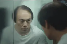 在脱发面前，明星不比普通人好到哪儿去图片