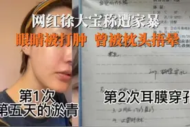 橘子晚报/网红叮叮喵结婚；彭于晏长这样了？图片