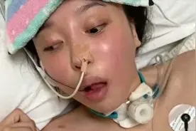 24岁北电校花突变植物人，“死亡作息”吓坏网友，三年后活成这样图片