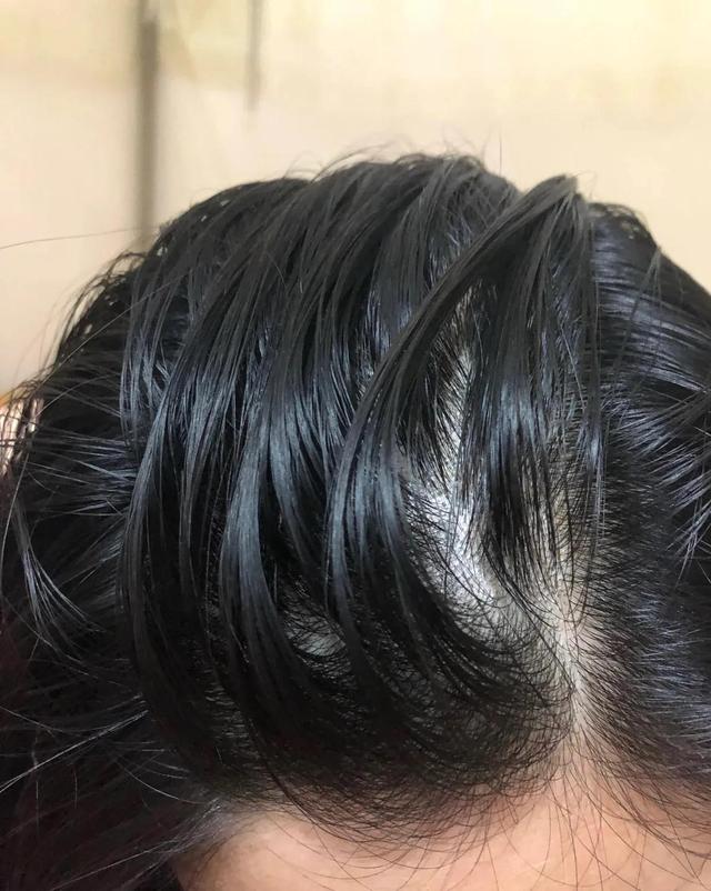 考研党头油掉发，这样洗发缝直接消失