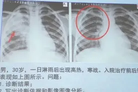 医学生写作业遇难题，伪装病人上网问诊，医生：你按教科书生病？图片
