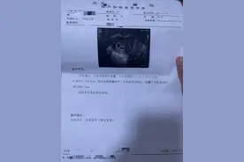 意外二胎收获双胞胎，该不该留下？图片