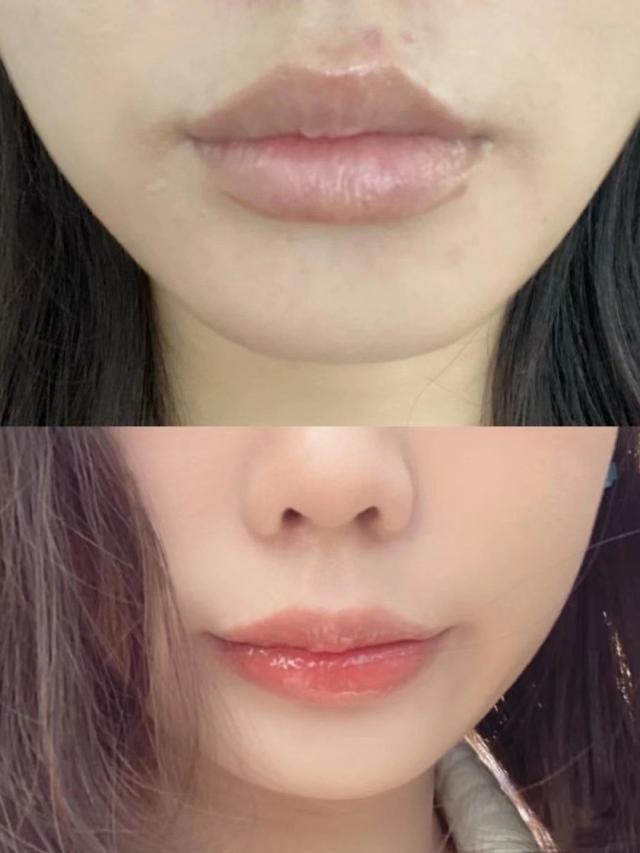 唇色发玫,老式唇线,怎么改?