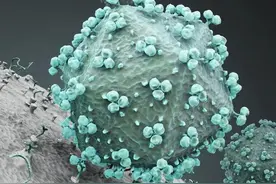 人类正接近“终结”艾滋病：根除感染；功能性治愈图片