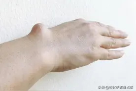 结节不要怕，简单一味药，化痰、软坚散结，改善你体内的结节图片