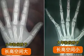 男孩女孩几岁青春期猛长个？几岁不长个？看这几点，不错过窜个期图片