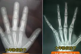 男孩女孩几岁青春期猛长个？几岁不长个？看这几点，不错过窜个期图片