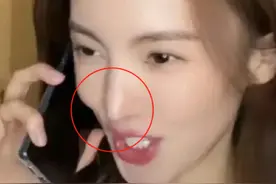 动脸的90后小花，缩鼻孔、打针填充，明明是美女，却个个怪异图片