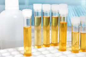 尿液颜色反映健康状况，解析11种尿液颜色，4招改善图片