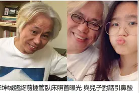 林靖恩公开李坤城临终照片：脸部肿胀，喉咙和鼻子在插管治疗图片