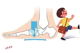 @太原家长 儿童扁平足暗藏的隐患很大！父母一定要重视图片