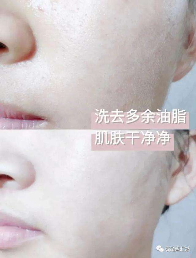 娉板浗Vlanse Q10鐗涘ザ娲楅潰濂剁敺濂?娓呮磥琛ユ按淇濇箍姘ㄥ熀閰告磥闈钩