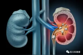 小便发黄，像豆油一样，是哪儿出了问题，要做什么检查？图片