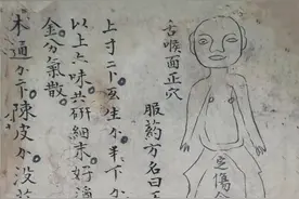 中医古籍善本 跌打损伤伤穴位秘方抄本图片