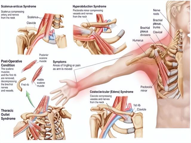 鐢查挻鑳虹敤鑽?澶х蹇岃娉ㄦ剰锛佺鐢ㄤ汉缇ゅ凡鍏紑鐖嗘枡锛屾偍鏄惁鍦ㄥ叾涓紵