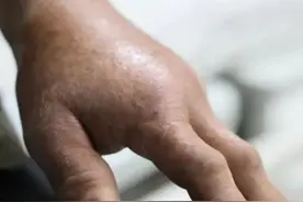 桂林男子手抓眼镜王蛇被咬，冬眠蛇出洞，遇到怎么办？防范很关键图片