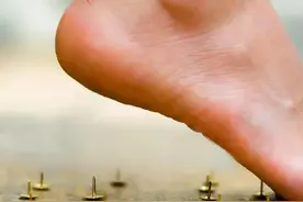 每6位成年人，即有一人会遭受足跟痛的折磨！该咋办？医生告诉您图片