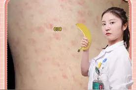 发生高危行为之后，多久可以检测出来？#医学科普 #涨知识  #梅du  #传染病  