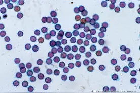 男性感染HPV？坚持这4件事就可以摆脱HPV的侵扰图片
